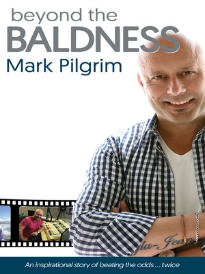 cover image of Beyond the Baldness